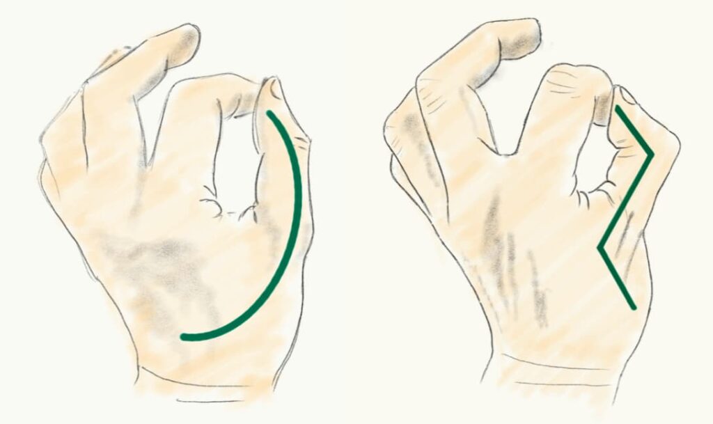 母指CM関節のバランス変化