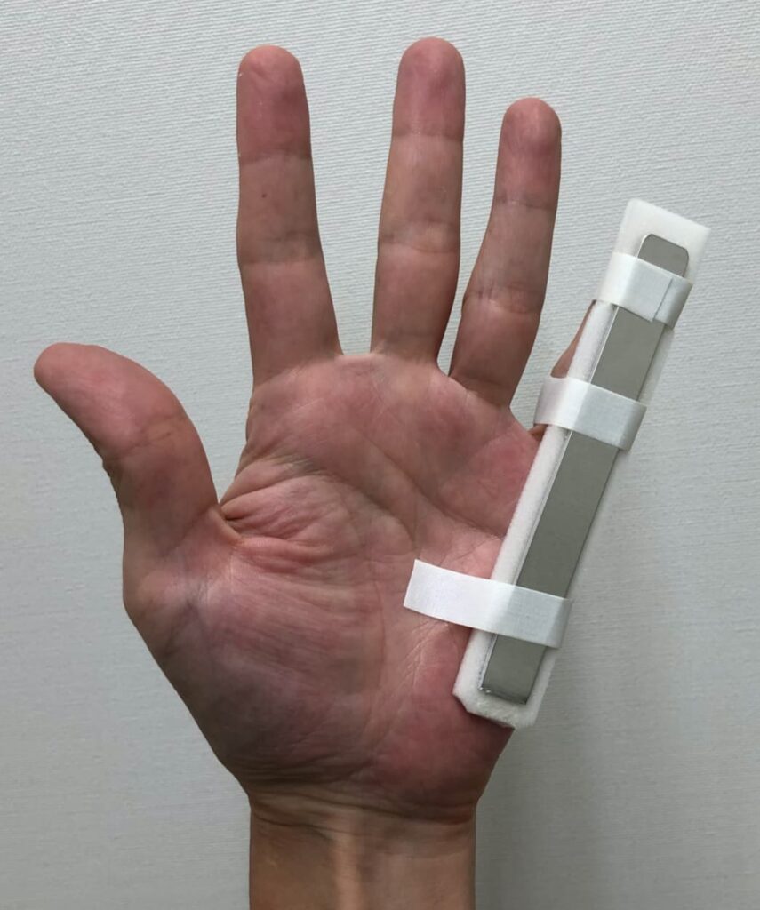 指の骨折